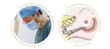 北京京韓隆胸失敗修復(fù)手術(shù)部分過程圖