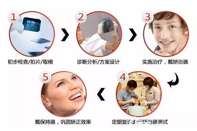 鄭州德正口腔金學(xué)來醫(yī)生介紹正畸問題 鄭州德正口腔金學(xué)來醫(yī)生介紹正畸問題