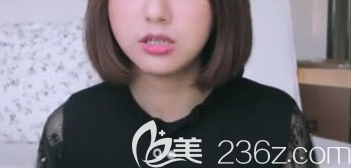 下顎矯正手術(shù)術(shù)后一年的樣子 下顎矯正手術(shù)術(shù)后一年的樣子