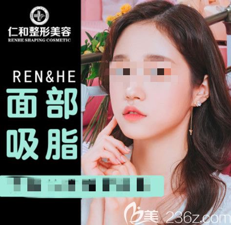 蘭州仁和劉顯超面部吸脂三個(gè)月效果圖片 蘭州仁和劉顯超面部吸脂三個(gè)月效果圖片