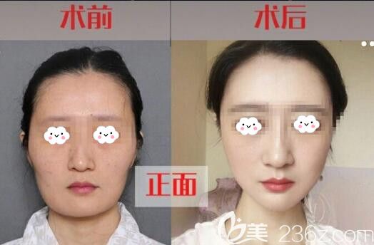 韓國金一秀醫(yī)生輪廓三件套<span style=