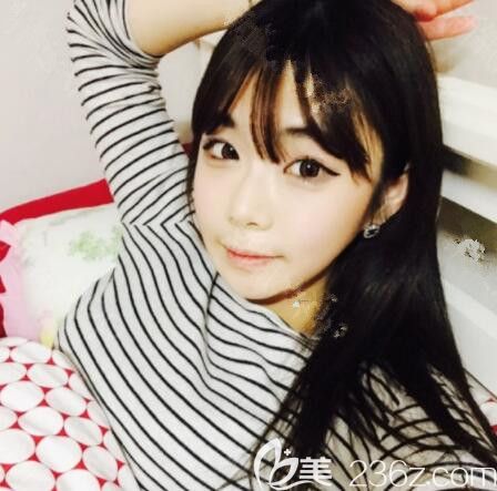 輪廓三件套打卡韓國首爾麗溫REON樸庭逸，沒有下垂反而更童顏了