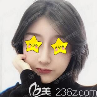 瑞韓整形醫(yī)院怎么樣？看海南瑞韓醫(yī)學(xué)美容醫(yī)院趙雙慶給我做的蘿莉翹鼻術(shù)后30天恢復(fù)效果還不錯(cuò)吧！