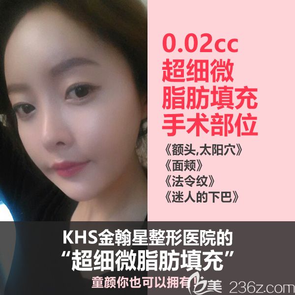韓國KHS金翰星整形醫(yī)院超細(xì)微脂肪移植