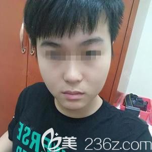 張斌醫(yī)生為我做光子嫩膚后皮膚透亮緊致 張斌醫(yī)生為我做光子嫩膚后皮膚透亮緊致