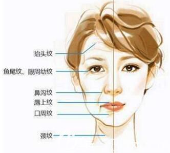 皮膚膠原蛋白流失導(dǎo)致面部出現(xiàn)各種細紋衰老現(xiàn)象