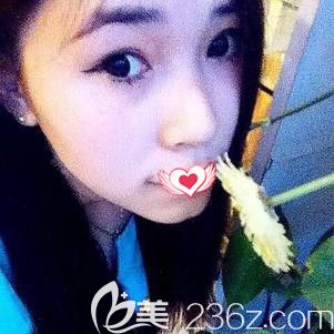 在石家莊天伊美做隆下巴術(shù)前是短縮下巴 在石家莊天伊美做隆下巴術(shù)前是短縮下巴