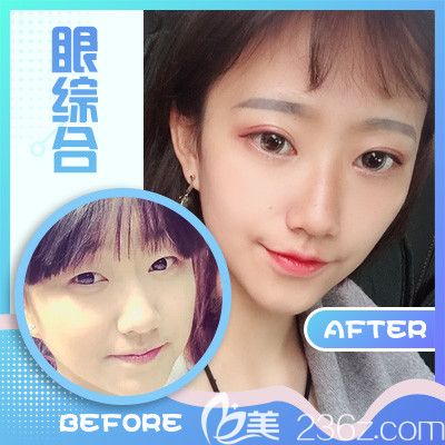 梅州曙光整形醫(yī)院怎么樣？2019年優(yōu)惠整形價(jià)格表及孫金貴雙眼皮隆鼻隆胸案例公布