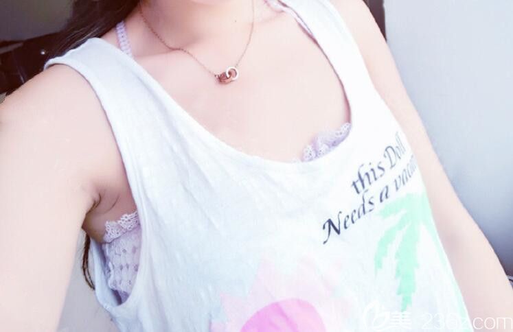 找合肥福華整形趙章杰做自體脂肪豐胸前 找合肥福華整形趙章杰做自體脂肪豐胸前