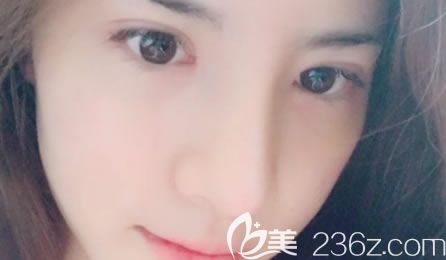 杭州薇琳吳學(xué)軍隆鼻手術(shù)<span style= 杭州薇琳吳學(xué)軍隆鼻手術(shù)<span style=