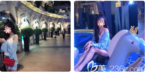 廣州中家醫(yī)家庭醫(yī)生大腿吸脂一個(gè)月術(shù)后