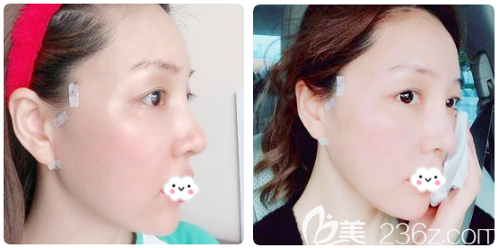 韓國(guó)優(yōu)雅斯<span style=