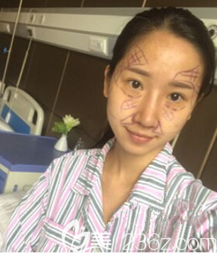 我的術(shù)前照顯老 我的術(shù)前照顯老