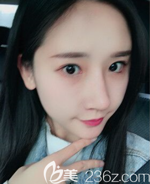 羅寧川主任給我做完手術(shù)23天 羅寧川主任給我做完手術(shù)23天