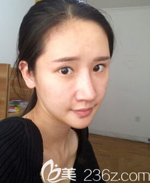 半個(gè)月后初見效果 半個(gè)月后初見效果