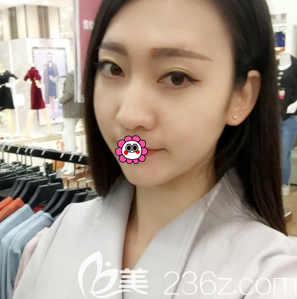 北京脂肪填充全臉哪家好?北京潤(rùn)美玉之光脂肪?？漆t(yī)院自體脂肪面部填充案例告訴你