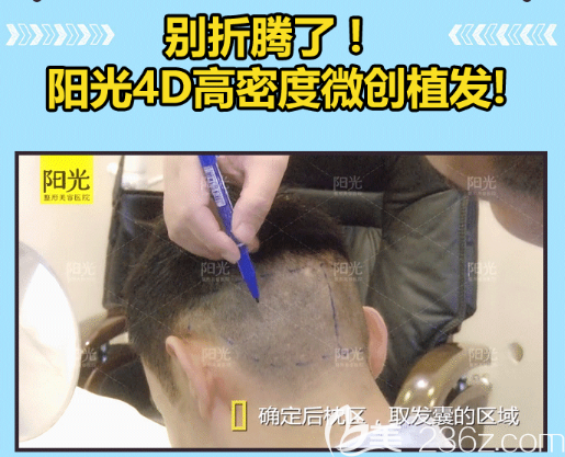 整形醫(yī)院4D高密度微創(chuàng)植發(fā)優(yōu)勢