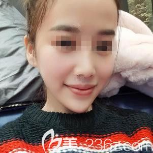 張學(xué)雷醫(yī)生注射瑞藍(lán)玻尿酸豐唇后3天擁有飽滿唇部 張學(xué)雷醫(yī)生注射瑞藍(lán)玻尿酸豐唇后3天擁有飽滿唇部