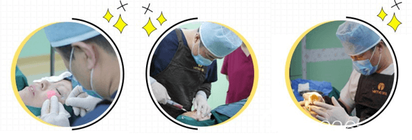 北京藝美改臉型手術(shù)過程示意圖