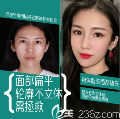 重慶好美整形怎么樣