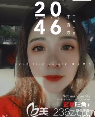 因為緊張害怕，我居然自我催眠在重慶好美整形做自體脂肪全臉填充時睡著了...