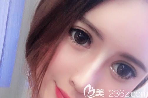 溫州藝興整形醫(yī)院林文君隆鼻<span style= 溫州藝興整形醫(yī)院林文君隆鼻<span style=