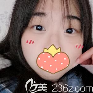 到武漢美基元做玻尿酸填充淚溝后效果可以說立即顯現(xiàn)？但為何有網(wǎng)友說術(shù)后十多天還淤青呢