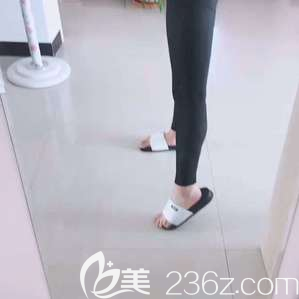 朱金成醫(yī)生給我做大腿吸脂減肥第7天樣子