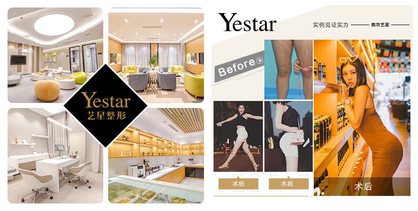 南京藝星環(huán)境和吸脂案例 南京藝星環(huán)境和吸脂案例