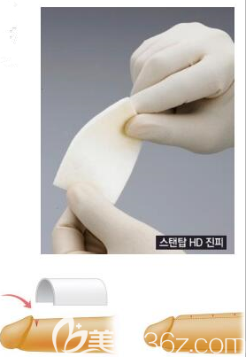 真皮生物補片的移植