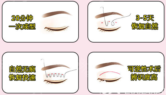 內江達芬奇納米無痕雙眼皮優(yōu)勢 內江達芬奇納米無痕雙眼皮優(yōu)勢