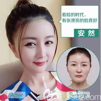 重慶華美做下頜角怎么樣