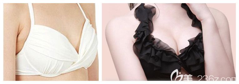 淮北哪家整形機(jī)構(gòu)好？淮北時(shí)光整形劉家賀和王鋒雙眼皮隆胸脫毛案例及價(jià)格供參考