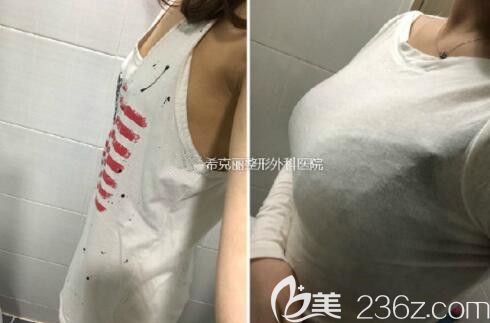 ??？他怱ECRET整形外科趙鏞瑾的一大波隆胸案例看的我都流鼻血了