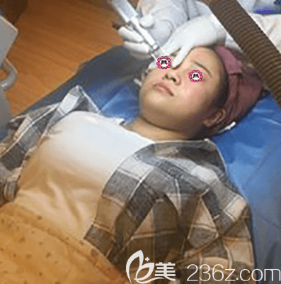 北京紫潔儷方醫(yī)生給我做超皮秒祛斑美膚當(dāng)天樣子