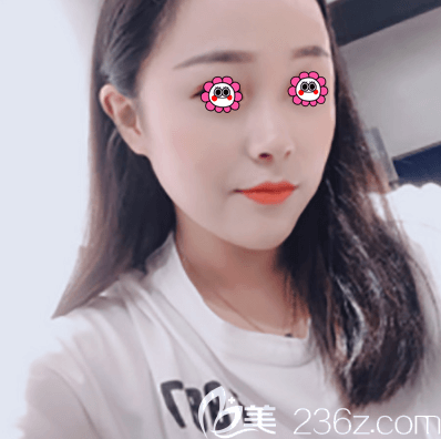 北京皮秒激光哪里好?我在北京紫潔醫(yī)美做超皮秒祛斑美膚效果獲肯定