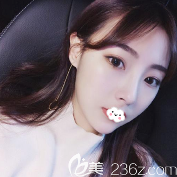 找深圳潤澤瑞尼絲王釗做耳軟骨隆鼻才兩個(gè)月就恢復(fù)自然了,這樣的技術(shù)真的讓人忍不住夸贊