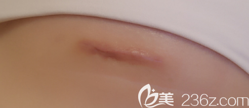 20190705_1562310850805622.png image.png