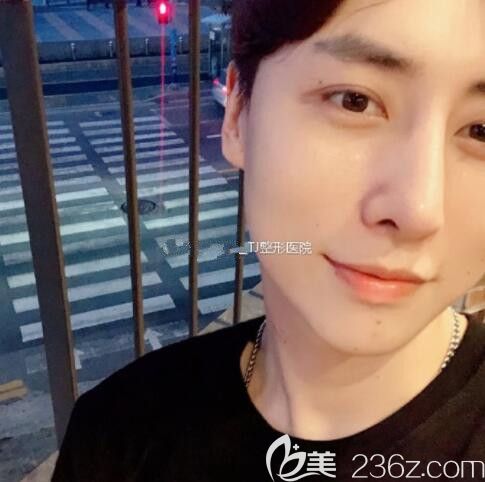 帥小哥在韓國(guó)TJ整形做了埋線雙眼皮脂肪填充駝峰鼻矯正術(shù)前術(shù)后對(duì)比