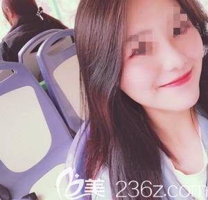 本來想做全臉填充醫(yī)生卻堅(jiān)持只讓我做自體脂肪填充太陽穴