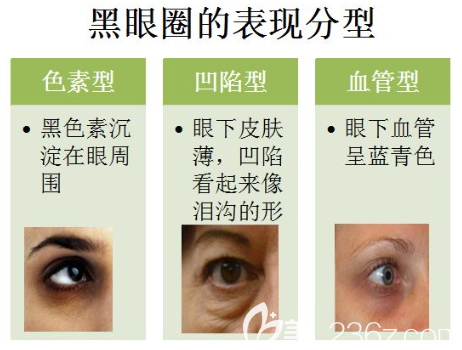 黑眼圈類型