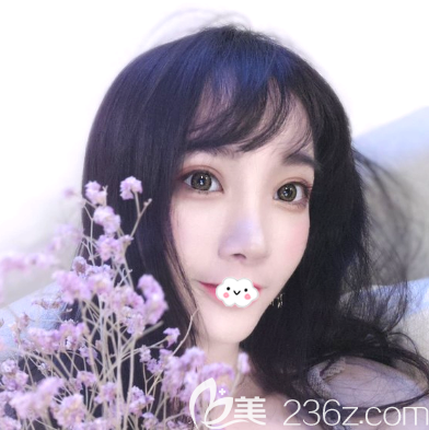 進(jìn)來感受一下我找深圳潤澤瑞尼絲劉庚醫(yī)生做完雙眼皮隆鼻后的驚人變化