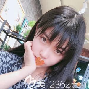 <!--<i data=20240703-sp></i>-->東醫(yī)生為我注射瘦臉一周有瘦臉效果 <!--<i data=20240703-sp></i>-->東醫(yī)生為我注射瘦臉一周有瘦臉效果