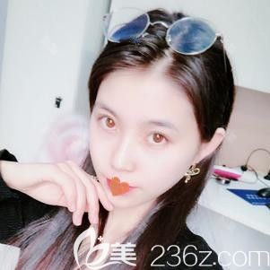 天宏<!--<i data=20240703-sp></i>-->東醫(yī)生注射瘦臉術后12天瘦臉效果明顯 天宏<!--<i data=20240703-sp></i>-->東醫(yī)生注射瘦臉術后12天瘦臉效果明顯