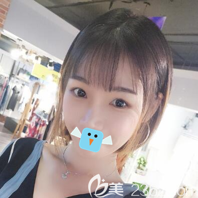 四川友誼醫(yī)院李繼華顴骨顴弓+下頜角整形術后效果圖 四川友誼醫(yī)院李繼華顴骨顴弓+下頜角整形術后效果圖