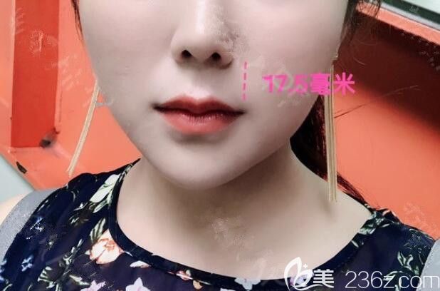 20190710_1562728955909777.jpg 20190710_1562728955909777.jpg