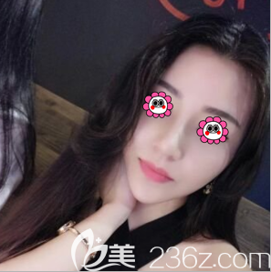 北京京韓隆鼻怎么樣？張振醫(yī)生鼻綜合案例效果參考