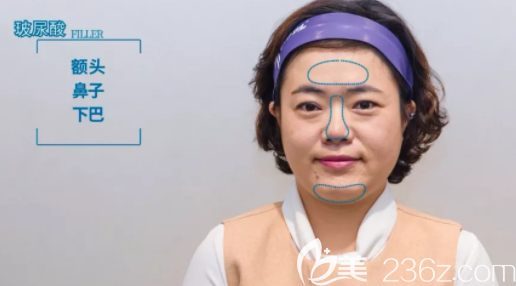 20190710_1562751999975221.png image.png