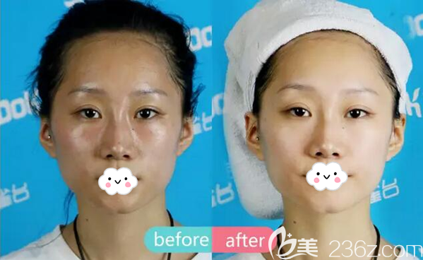 成都銅雀臺(tái)雷國(guó)婕水動(dòng)能祛斑對(duì)圖