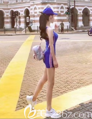 在成都西區(qū)醫(yī)院找宋華敬做了大腿吸脂減肥以后，我才發(fā)現(xiàn)大象腿變大長腿這么簡單